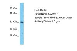 LCHN Rabbit anti-Human, Polyclonal, Novus Biologicals 0.1 mL | Buy Online | Novus Biologicals | Fisher Scientific